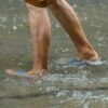 Leptospirosis2025 06 1017 05 31 2025 07 25 23 37 14