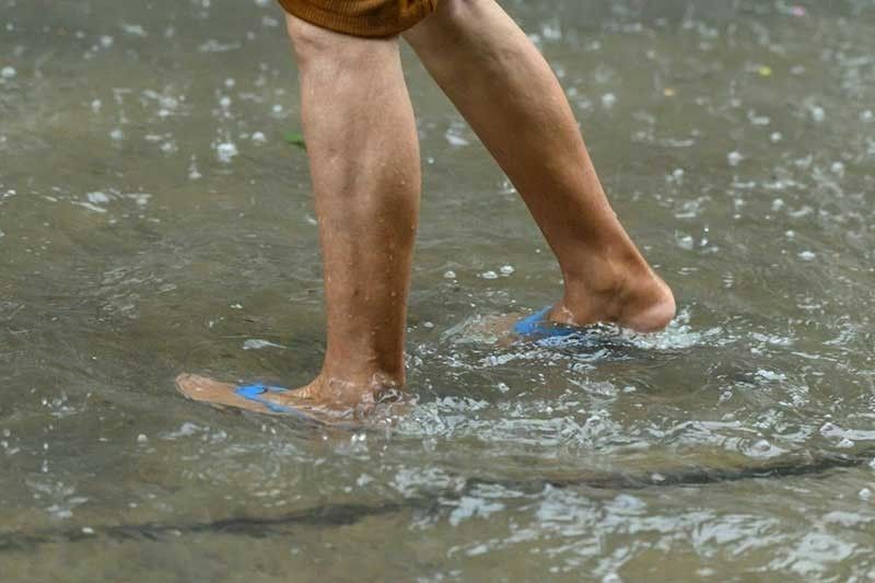 Leptospirosis2025 06 1017 05 31 2025 07 25 23 37 14