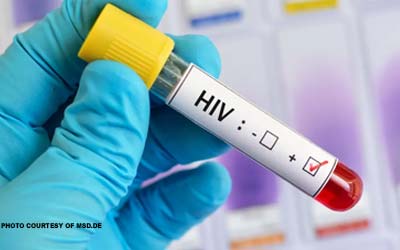 HIV