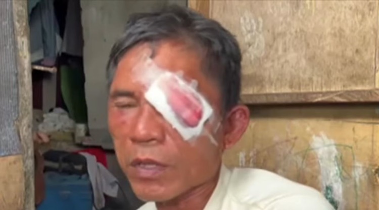 E-trike Drivers Bite Each Other Over Dispute for Passengers