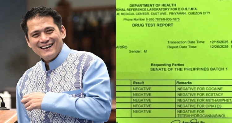 Robin Padilla Voluntarily Submitted To Random Drug Testing