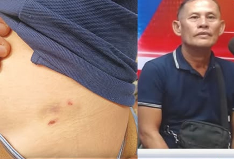 バコロド市広場で野良犬に噛まれた写真家の訴え